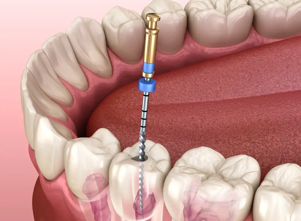 The Coffee Lover’s Guide To Maintaining White Teeth